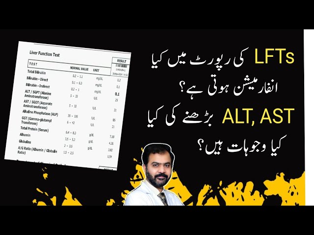 LFTs interpretation by Dr Raja Ikram