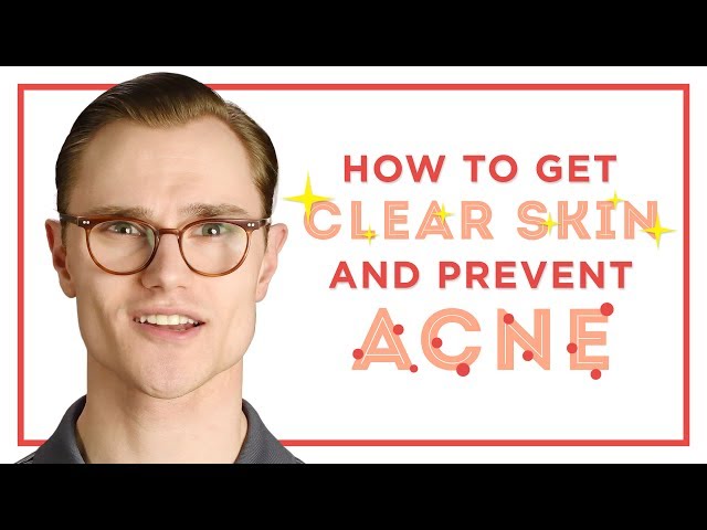 How To Get Clear Skin & Prevent Acne - Skincare Tips for Men