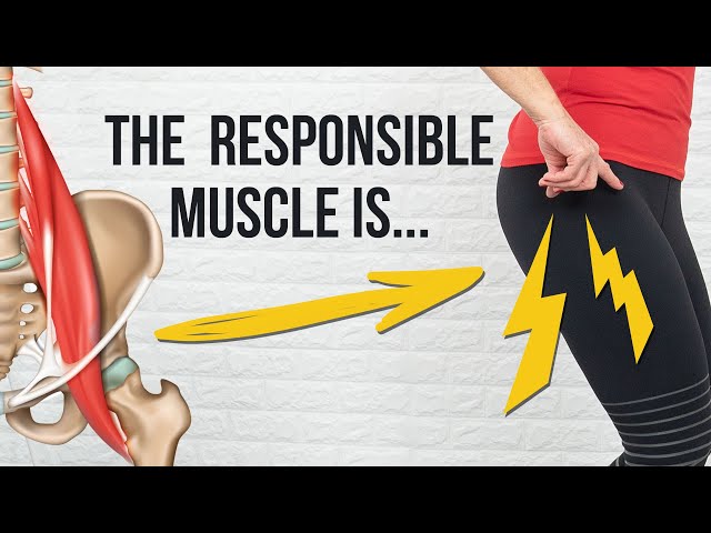 This Muscle Causes HIP PAIN - Do This & See what Happens