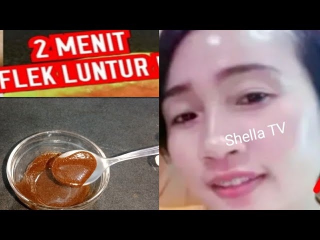 Luar Biasa !!! Cara Cepat Hilangkan Flek Hitam Kerutan Di Wajah #ShellaTV