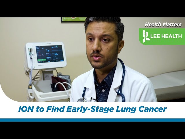 ION to Find Early-Stage Lung Cancer