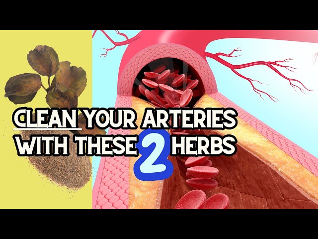 How to UNCLOG your arteries NATURALLY using HERBS