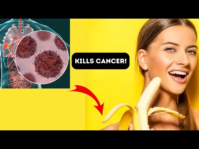 Proven Cancer-Fighter,Why? You Shouldn't Throw Away Banana Peels!