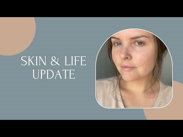 SKIN & LIFE UPDATE | 12 months in Bangkok and healing with CAP Therapy