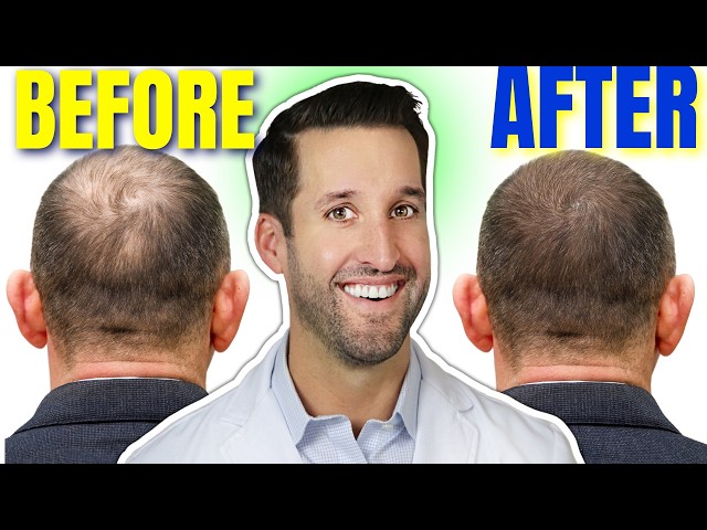 HAIR LOSS? 12 Doctor-Approved Ways to STOP Hair Loss & Regrow Hair