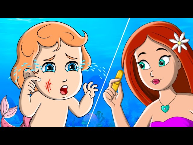 Baby Got A Boo Boo Song | FunForKidsTV - Nursery Rhymes & Baby Songs