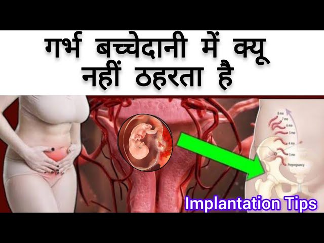 प्रेग्नेंसी क्यू नहीं रूकती है? प्रेग्नेंसी कैसे होती है? | implantation & Ovulation Tips |