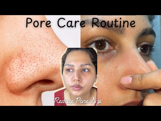 4 Step Skincare Routine for Blackheads & Whiteheads / Shrink Pore Size #easyskincareroutine