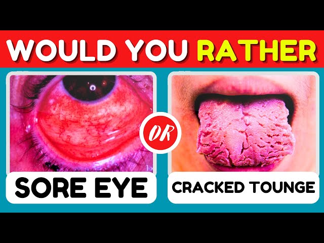 Would You Rather HARDEST Choices Ever (Above Impossible Level ! 😱😲)