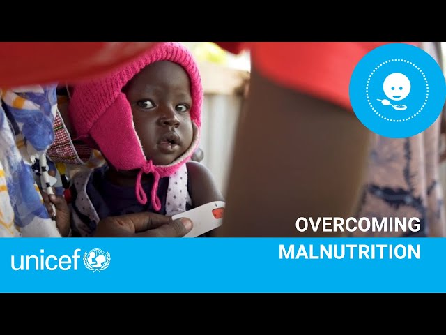 Overcoming malnutrition I UNICEF South Sudan