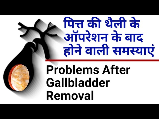 पित्त की थैली के ऑपरेशन के बाद की समस्याएं और समाधान | Common Problems After Gallbladder Removal