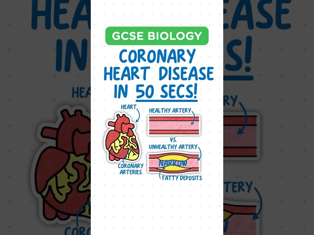 GCSE BIOLOGY - Coronary Heart Disease