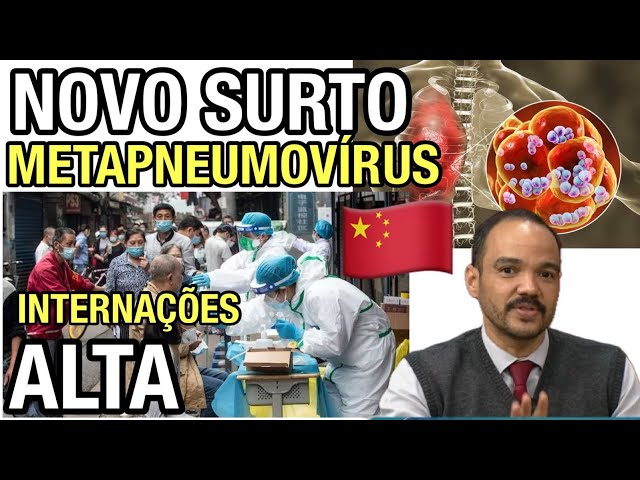 Novo Surto de Metapneumovírus Humano (hMPV) na China: Entenda o Risco e Como se Proteger