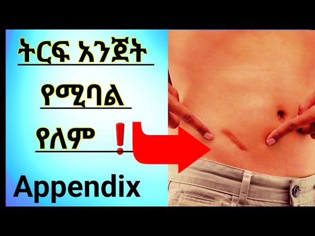 አጣዳፊው ትርፍ አንጀት 🛑appendix ምንነት: መንስኤ: ምልክቶችና 📌 መፍትሔው #appendicitis #ethiopia