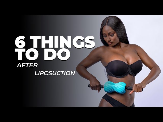 Liposuction Recovery: 6 Must-Do's for AMAZING Results