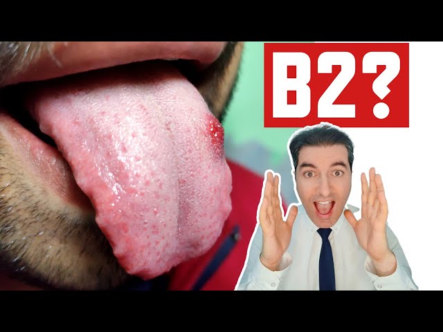 Uncover the Shocking Symptoms of Vitamin B2 Deficiency!