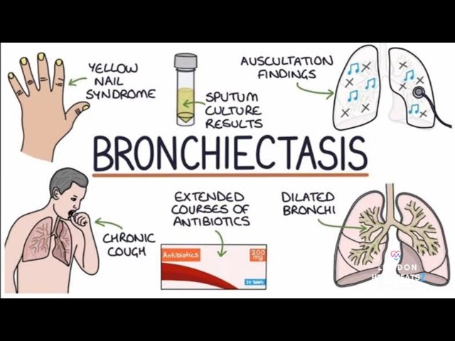 Pulmonology : Asthma, COPD, pneumonia, bronchiectasis, cystic fibrosis, mediastinum, ARDS, neoplasms