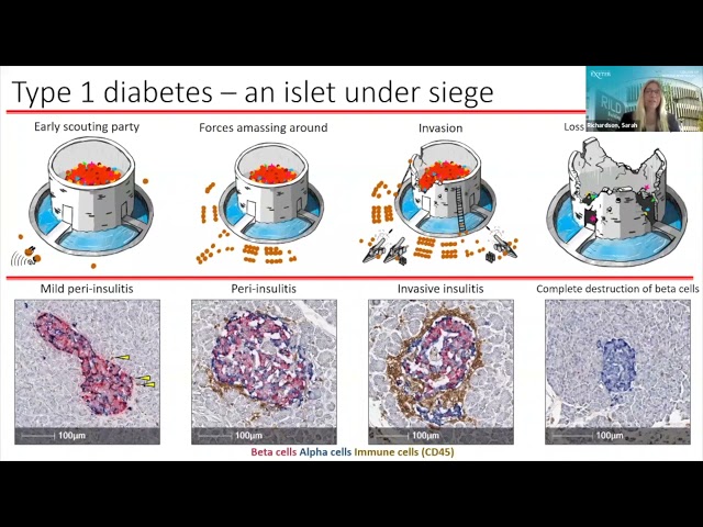 Type 1 diabetes: A tale of the pancreas under siege | Professor Sarah Richardson