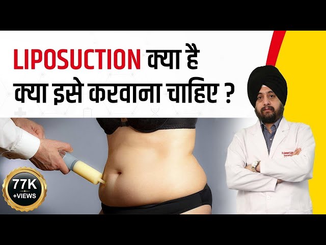 Liposuction For Weight Loss, Surgery Cost, Procedure, Side Effects, Tummy Tuck Abdominoplasty