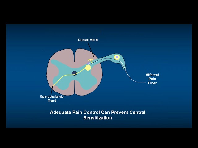 The Future of Pain: Optimizing Multimodal Analgesia in a New Era for Managing Pain