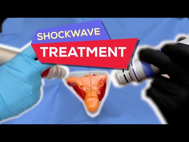 Shockwave Therapy for Erectile Dysfunction 2022 - Can this help you? - Rebalance