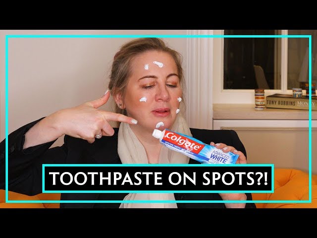 Dr Debunks: Does Toothpaste Get Rid Of Spots?