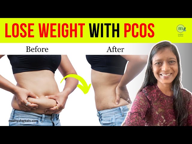 PCOS Weight Loss: 5 Amazing Ways to Beat Insulin Resistance