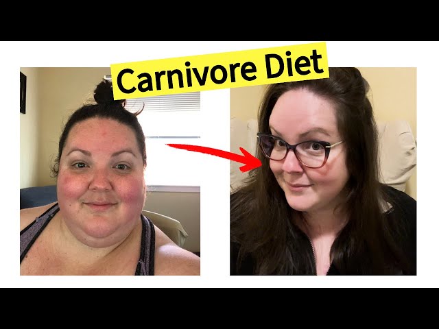 | Showing Up: Day 43 | 110+ lbs. LOST on Carnivore Diet