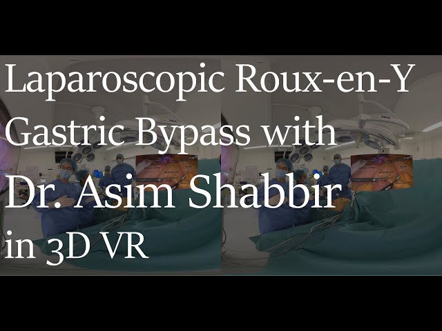 3D VR Laparoscopic Roux-en-Y Gastric Bypass surgery (Teaser)