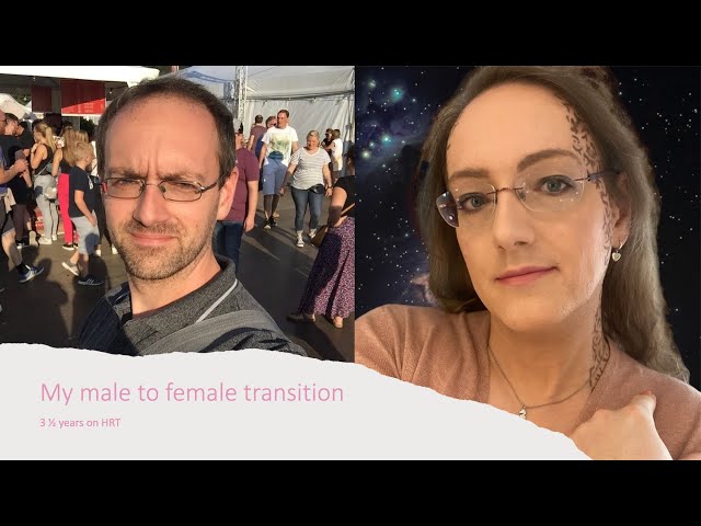 My Male to Female Transition Timeline | 3 1/2 years on HRT