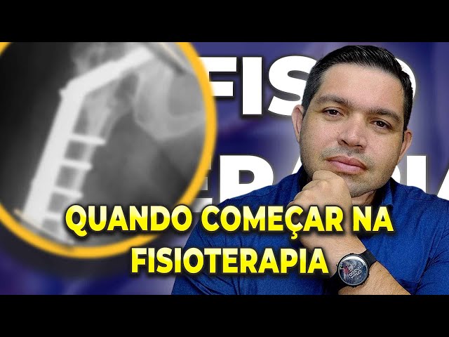 Quando devo iniciar a Fisioterapia após uma FRATURA?