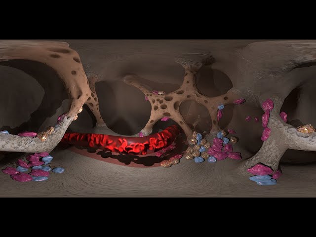 What Does Osteoporosis Look Like - a 360 degree animation