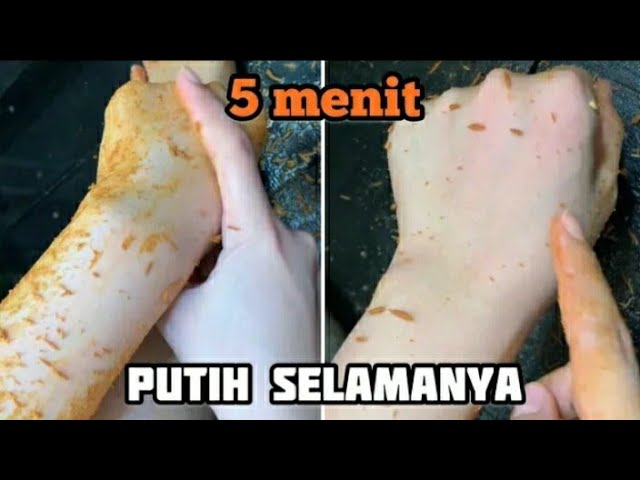 VIRAL VIDEO CARA MEMUTIHKAN KULIT DENGAN CEPAT