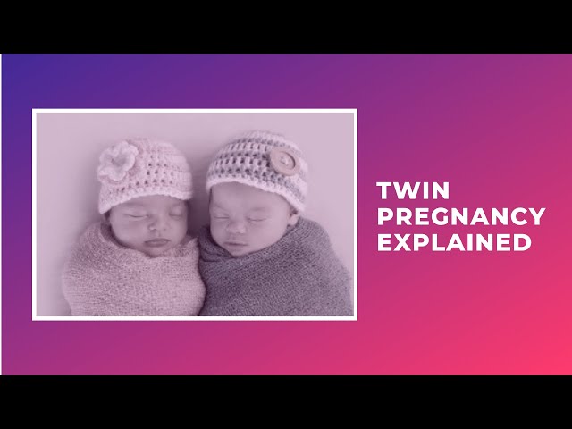 Twin pregnancy explained in Bangla | Dizygotic twin | Monozygotic twin |