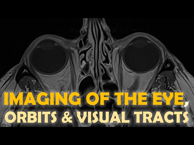 Imaging of the eye and visual system... more than meets the eye!