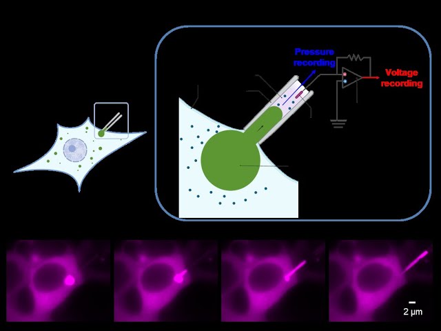 Zheng Shi: Aspirating Condensates in Living Cells