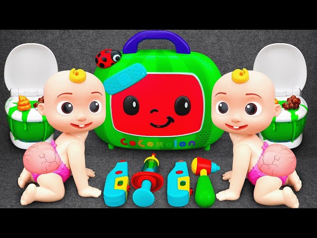 🔴 LIVE 🔴 Doctor Toys Rescue Cocomelon from Butt Acne ASMR | Satisfying Unboxing Ambulance Playset