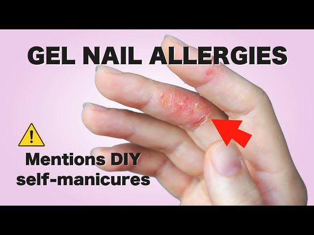 Avoid Gel Nail Allergies: Professional Safety Tips for DIY Nail Enthusiasts