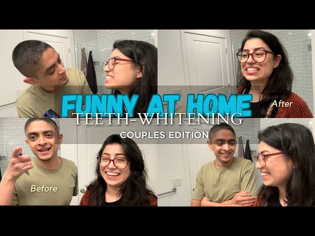 Laugh Your Way to a Brighter Smile! 😂 Hilarious Teeth Whitening Strips Shenanigans: Before & After!🤣