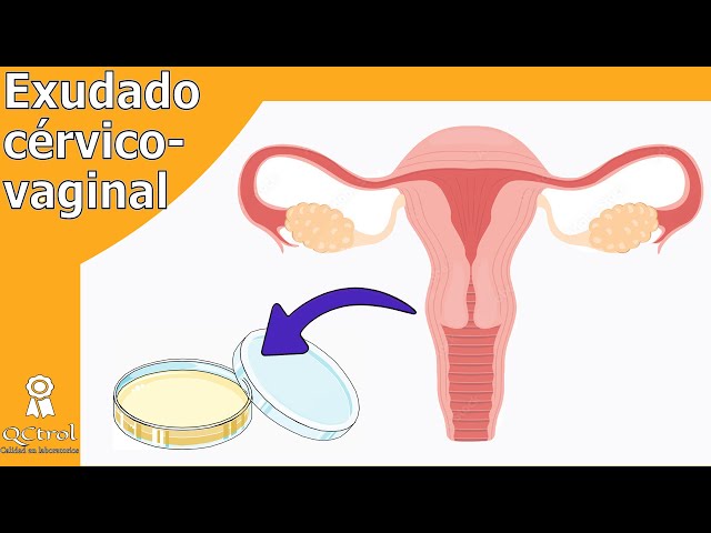 Cervical - vaginal culture: SAMPLE PROCEDURE and pathogens