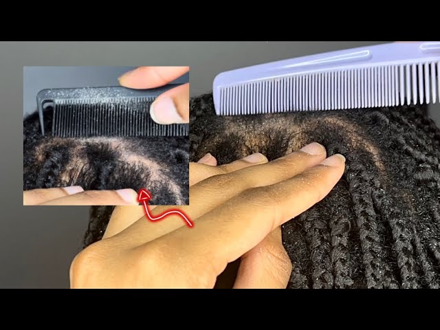 1 HR ASMR BRAIDS scratching, scalp inspection & white hair plucking!! | ASMReagan