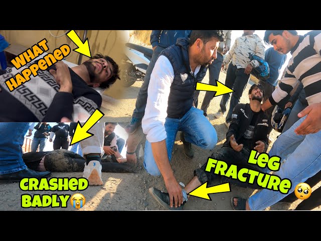 My Last Vlog😭Badly Crsah | Badly Injured-What Happened 😨 GOOD DAY