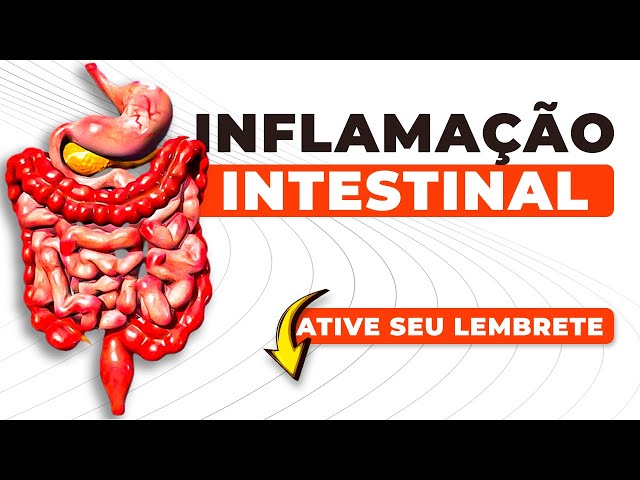 EMAGREÇA RÁPIDO com o MELHOR SUPLEMENTO Natural - SECA BARRIGA e LIMPA INTESTINO