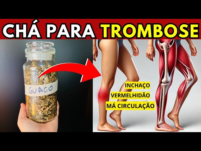 Use este CHÁ para DESINFLAMAR o CORPO e PREVENIR TROMBOSE, VARIZES e VASINHOS | Faça em Casa (GUACO)