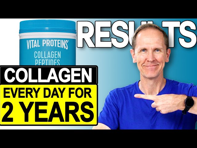 Vital Proteins Collagen Peptides | Results After 2 Years