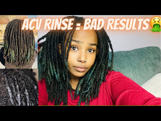 WATCH THIS BEFORE YOUR ACV RINSE | BAD RESULTS!