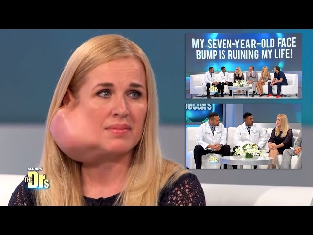 My Journey with a Parotid Tumor on The Doctors TV Show Changed My Life