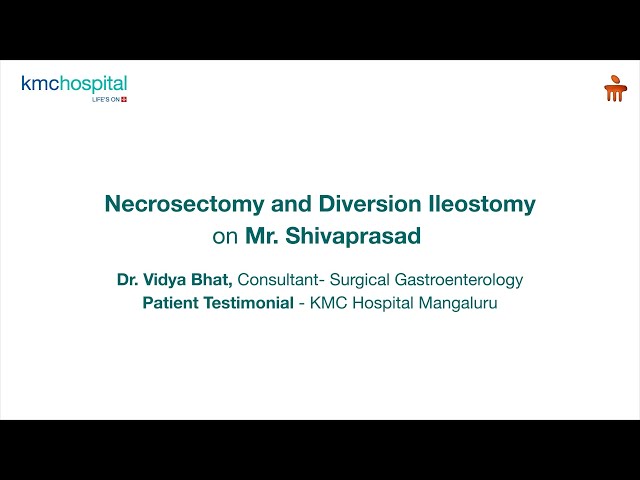 KMC Hospital | Necrosectomy and Diversion Ileostomy | Patient Testimonial | Dr. Vidya Bhat