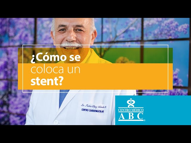 ¿Cómo se coloca un stent?