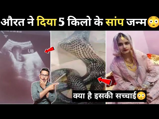 औरत ने दिया 5 किलो के सांप जन्म क्या है सच्चाई? Marriage Girl Sanke Birth viral video, AllinoneNews